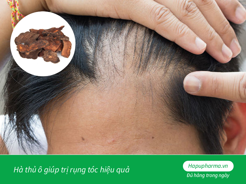 Hà thủ ô giúp trị rụng tóc hiệu quả